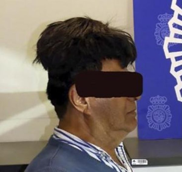 man hiding cocaine under his toupee