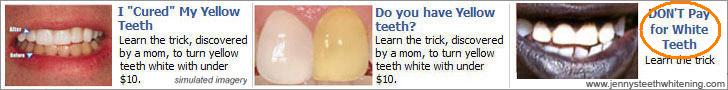 Rascist teeth whitening ad