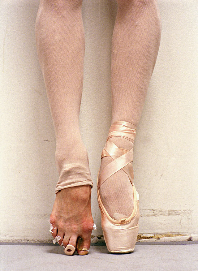 The battered feet of a professional ballerina.