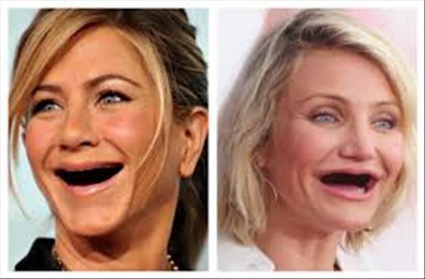 Celebrities without teeth