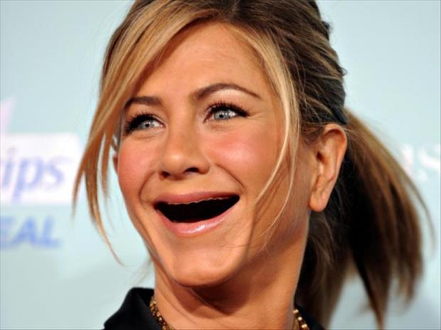 Celebrities without teeth