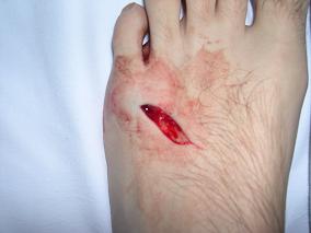 One of my friends accidentally shot my other friend in the foot. OUCH!