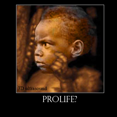 If this was your 3D ultrasound, would you still be prolife?