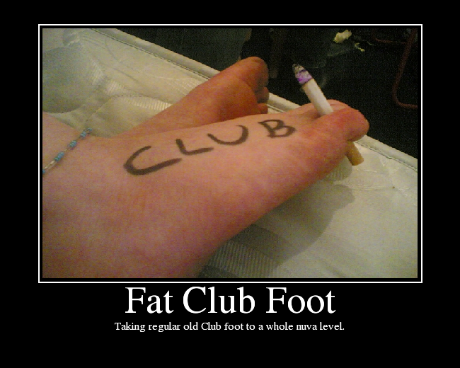 Taking regular old Club foot to a whole nuva level.