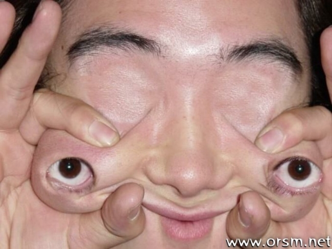this guy can stretch his eyes!