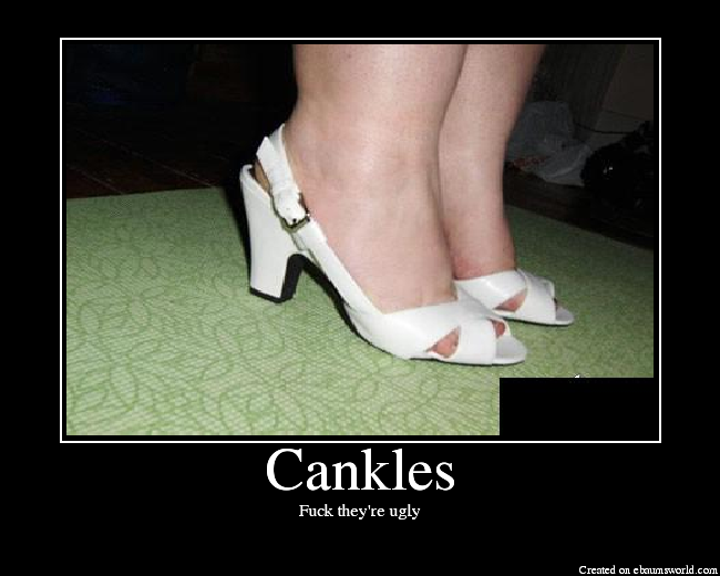 Cankles. 