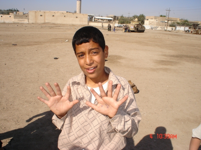 this kid was born with 12 fingers because of sadams nerve gas attack on his own people in the 80's,  many more were also affected.