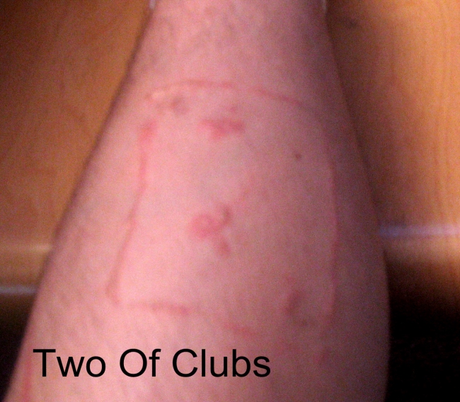 This stupid kid burned the two of clubs card into his leg.