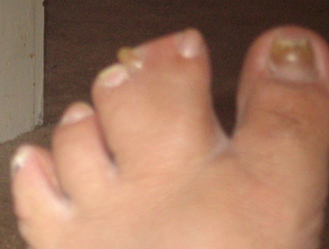 my husbands toes