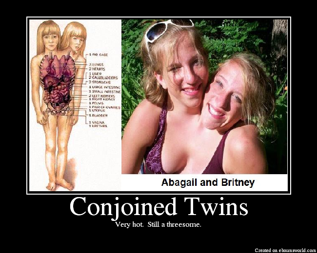 Brittany abby nude and hensel Conjoined twins. 