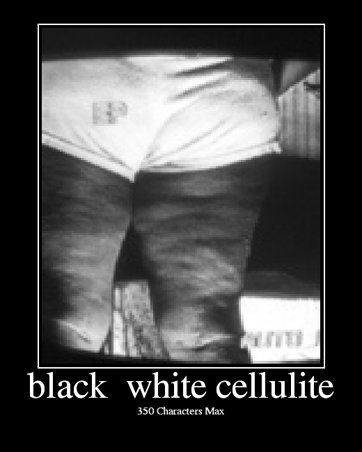 Black White Cellulite Picture Ebaum S World
