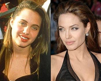 Celebrities - Then And Now