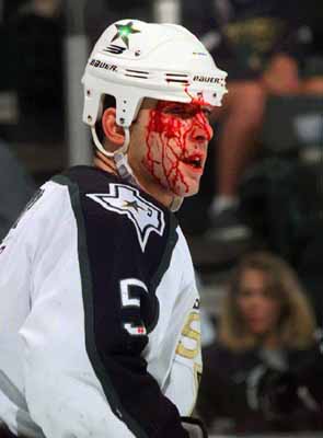 Bloody Faces of Sports