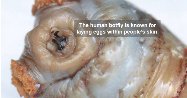 close-up of a creepy, worm-like bug. text reads: The human botfly is known for laying eggs within people's skin.