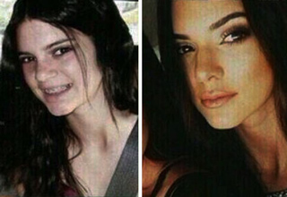 The epic effects of puberty.