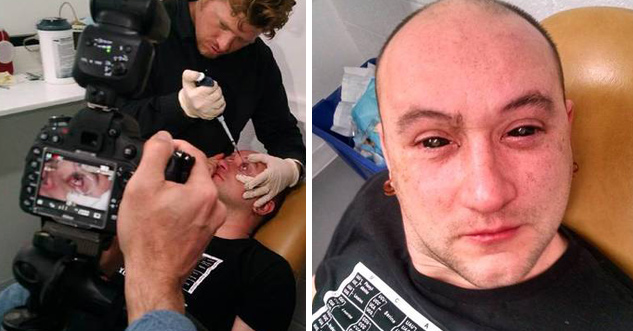 Left side: guy gets injection in his eye ball. People take photos. Right side: His eyes look like giant pupils.