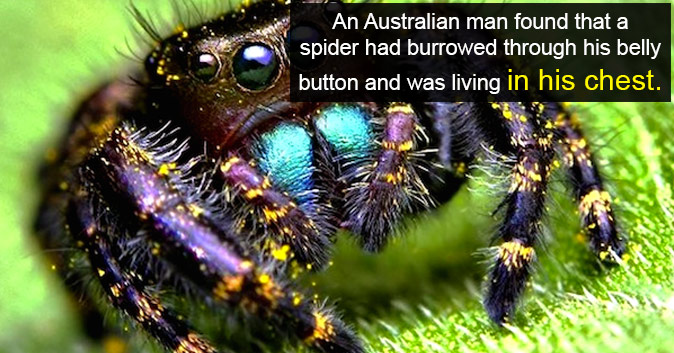 An Australian man found that a spider had burrowed through his belly button and was living in his chest.