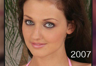 Aletta Ocean started getting plastic surgery around 2007, and the subtle changes have added up….