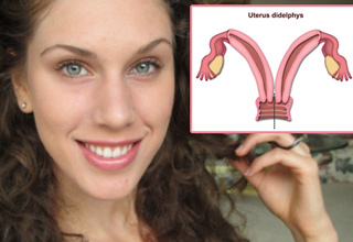 Cassandra became famous because of her Youtube videos, where she admits to having a condition called uterus didelphis, which means she has two vaginas.