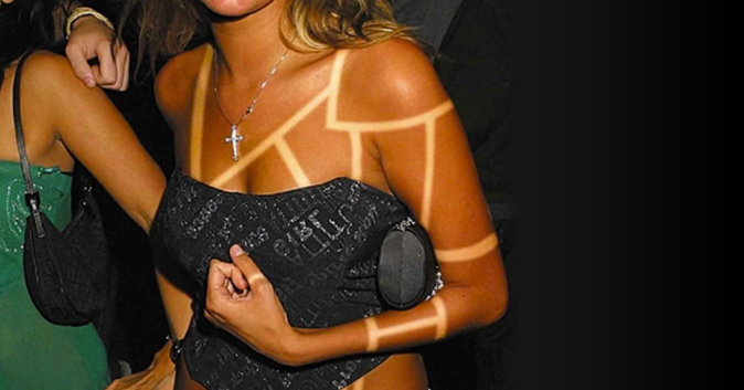 Sunburn Art is a Real Thing, and It's Glorious