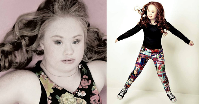 Down's Syndrome Teen Wants to be a Model