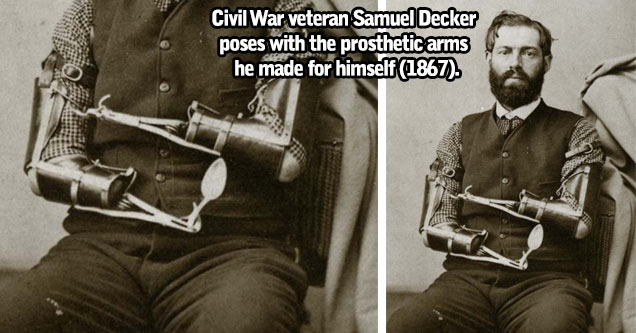 Civil War veteran Samuel Decker poses with the prosthetic arms he somehow made for himself (1867).