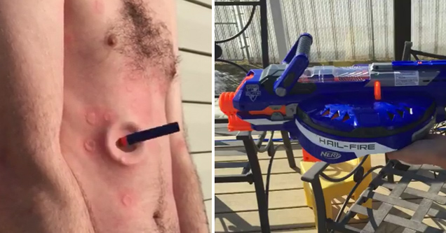 Modded Nerf Gun Ends In Pain