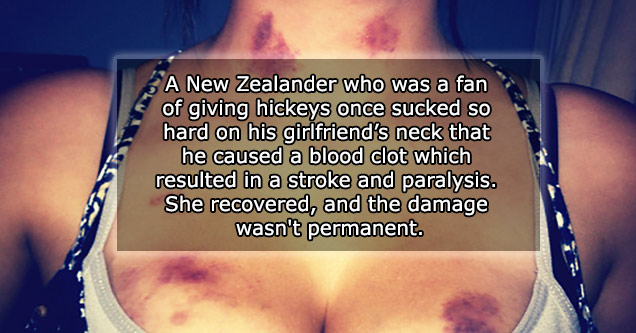 10 Sex Related Injuries That Will Make You Cringe