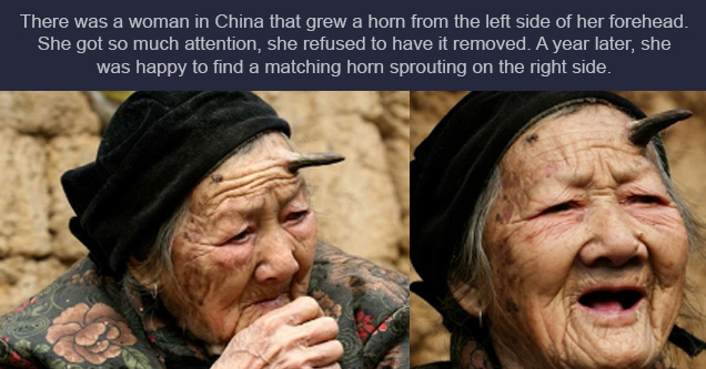 photo caption - There once was an old woman from China that grew a horn on the left side of her forehead. She got so much attention, she refused to have it removed. A year later, she was happy to find a matching horn sprouting on the right side.