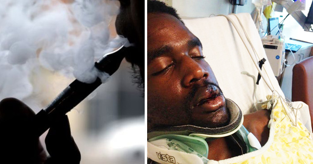 Man’s E-Cigarette Blows Up In His Face