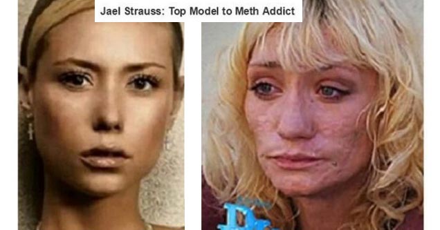 meth addict - Jael Strauss Top Model to Meth Addict