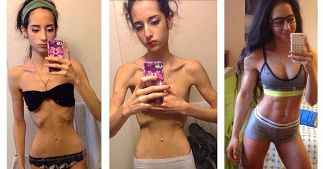 One Girl's Amazing Body Transformation