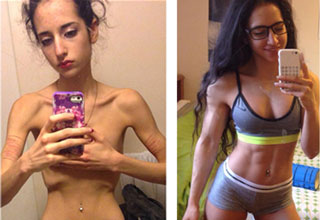 A former sufferer of Anorexia changes her body and her life.