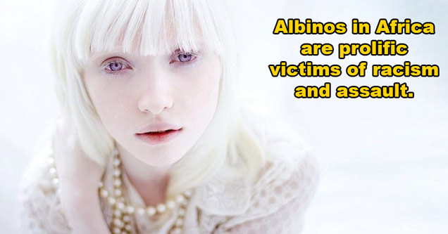 albino woman text says in africa albinos are victims of racism and assault