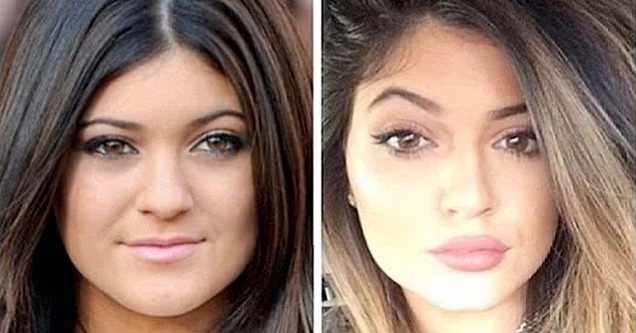 kylie jenner looking different in 2 pics