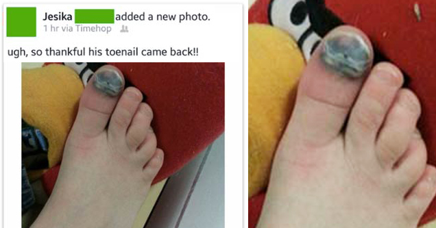 toenail growing back