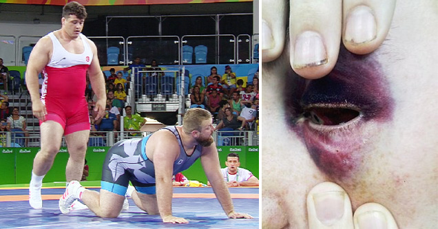 wrestlers getting in position and bruised eye