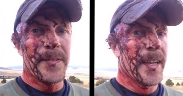 Montana Man Survives Brutal Bear Attack and Describes It Moments Later