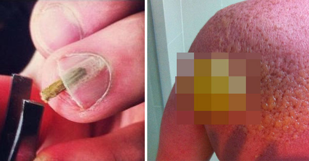 Disturbing Photos That Will Surely Make You Cringe