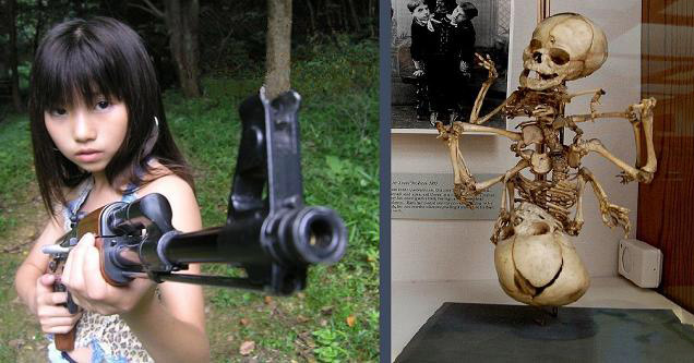 firearm - . conjoined twins skeleton - ht