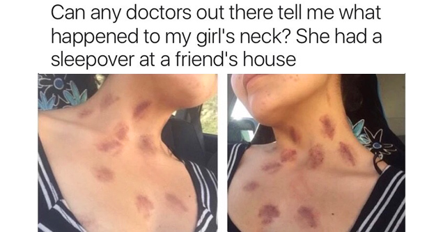 girl with hickeys all over neck and mom asking if any doctors know what it is