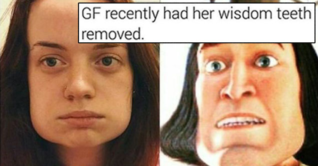 27 Random Images For Your Gander Globs - cover graphic of GF who had wisdom teeth pulled and now has real flat jaw line like a cartoon character.