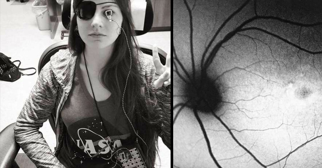 24 Year Old Girl figures out how to restore her eye sight