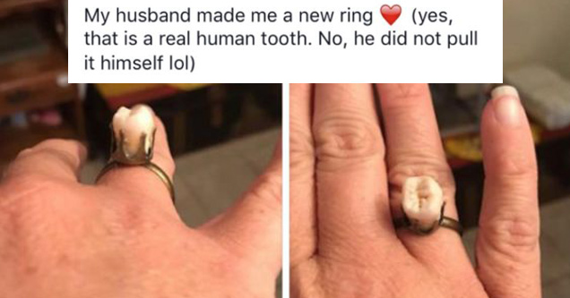 My husband made me a new ring yes, that is a real human tooth. No, he did not pull it himself lol