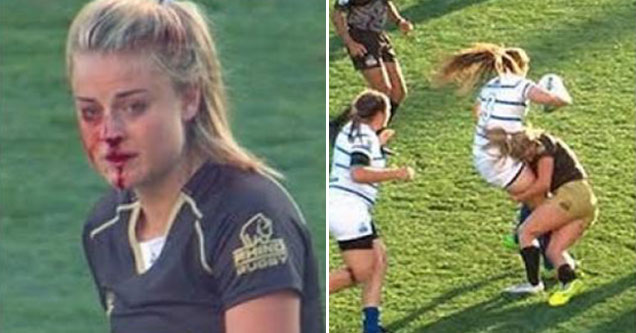 rugby girl will break your nose and melt your heart