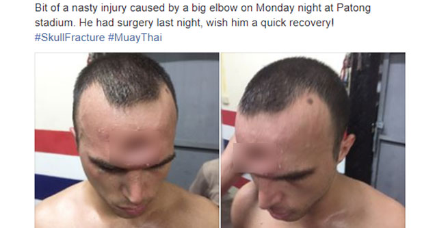 muy thai fighter took an elbow to the head