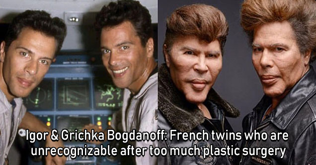 igor and grichka bogdanoff, french twins who had too much plastic surgery