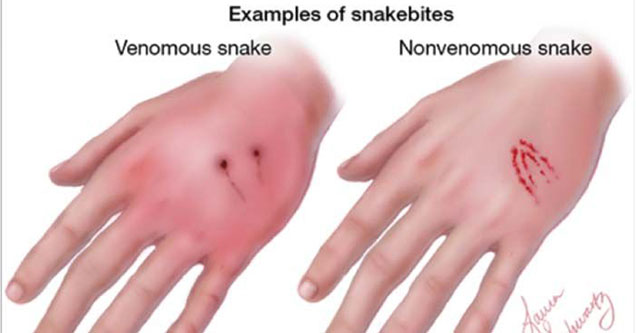 A Definitive Guide To Deadly And Non-deadly Snakes - Ftw Gallery ...