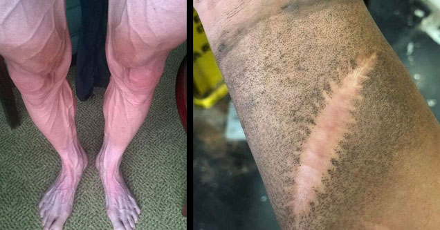 weird but cool pics | a mans legs with veins popping out and  a scar with no hair on it