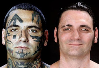 It hurt very much to remove his disturbing face tattoos, but not as much as the realization how wrong he was.